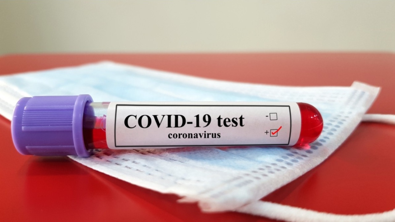 Britaniya-stammi-koronavirus-covid-19-test
