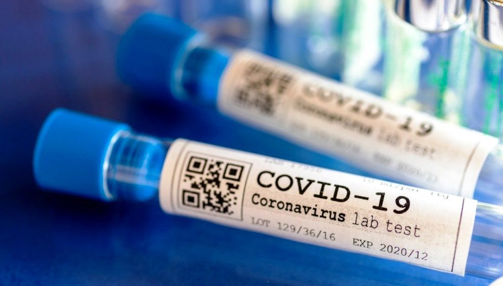 Koronavirus (COVID-19) testi